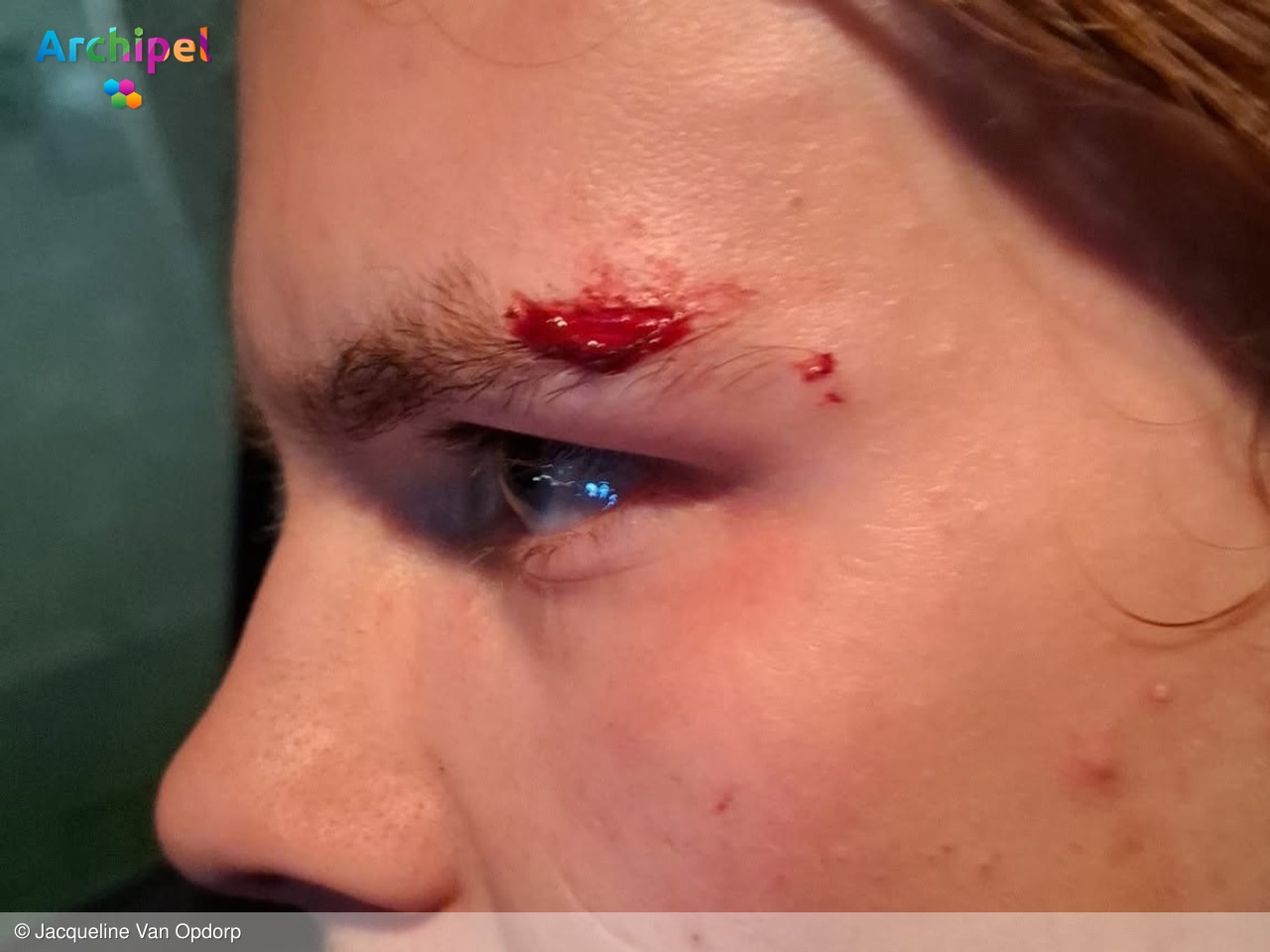 Jongen mishandeld bij skatepark Middelharnis, familie zoekt camerabeelden